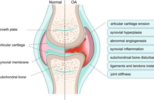 Chondroitin Sulfate: Your Natural Solution for Osteoarthritis Relief