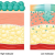 High vs Low Molecular Weight hyaluronic acid