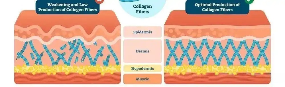 Collagen: The Skin’s “Support Framework”